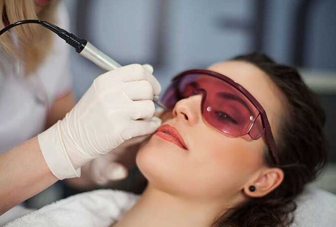 Biorevitalizare laser