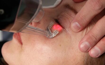 procedura cu laser de întinerire a pielii faciale